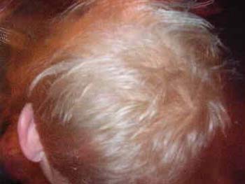 BGD-Jubilumsturnier 2003